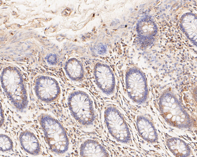 TREM2 Antibody in Immunohistochemistry (Paraffin) (IHC (P))