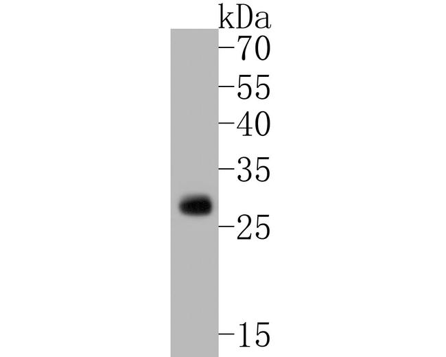 TREM2 Antibody in Western Blot (WB)