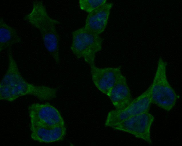 PICK1 Antibody in Immunocytochemistry (ICC/IF)