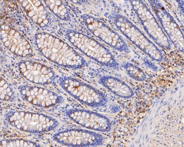 PICK1 Antibody in Immunohistochemistry (Paraffin) (IHC (P))