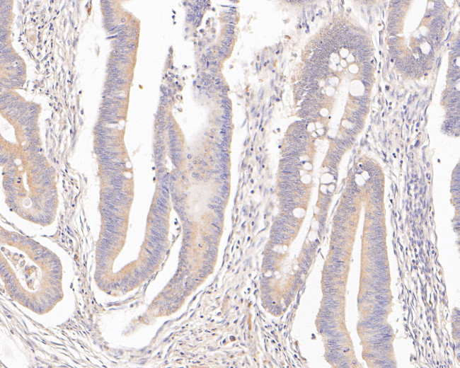 MTHFD2 Antibody in Immunohistochemistry (Paraffin) (IHC (P))