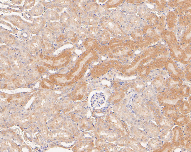 MTHFD2 Antibody in Immunohistochemistry (Paraffin) (IHC (P))