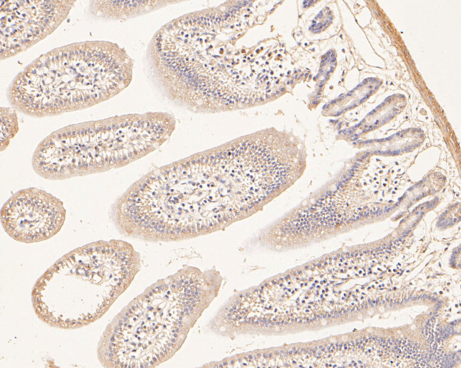 MTHFD2 Antibody in Immunohistochemistry (Paraffin) (IHC (P))