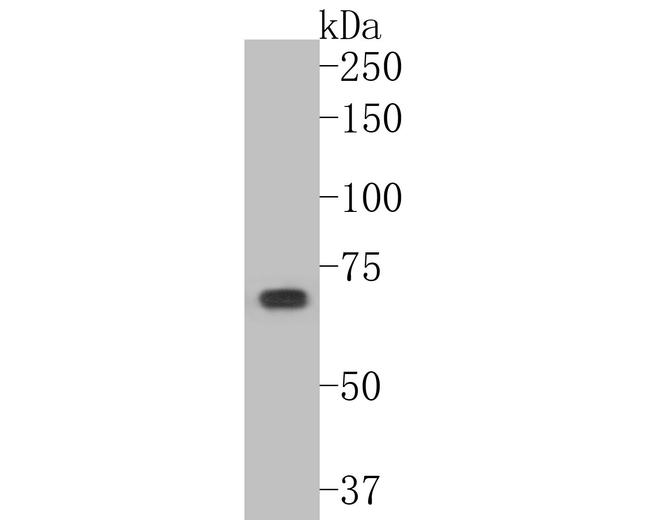 Optineurin Antibody in Western Blot (WB)