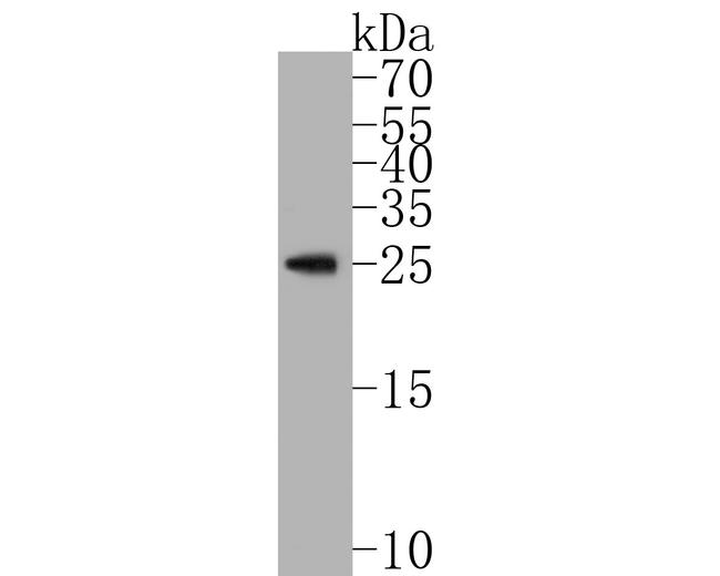 RAB27B Antibody in Western Blot (WB)