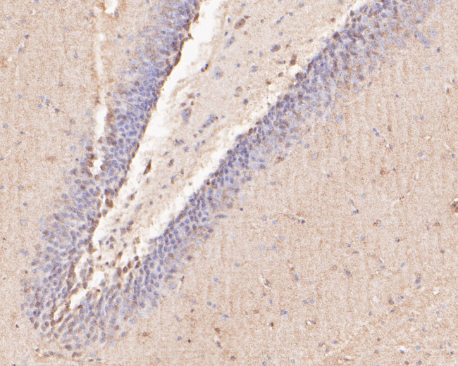 TTL Antibody in Immunohistochemistry (Paraffin) (IHC (P))