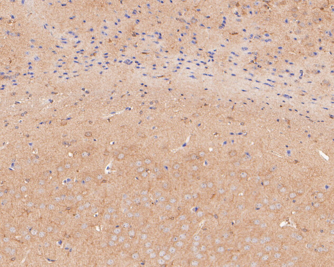 TTL Antibody in Immunohistochemistry (Paraffin) (IHC (P))