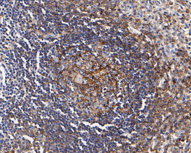 CD35 Antibody in Immunohistochemistry (Paraffin) (IHC (P))