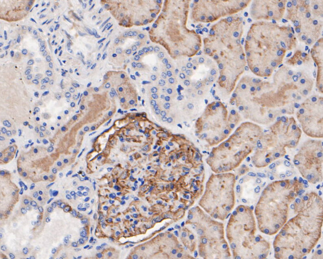 CD35 Antibody in Immunohistochemistry (Paraffin) (IHC (P))