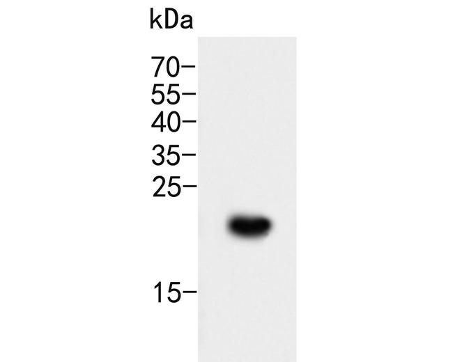 CD35 Antibody in Western Blot (WB)