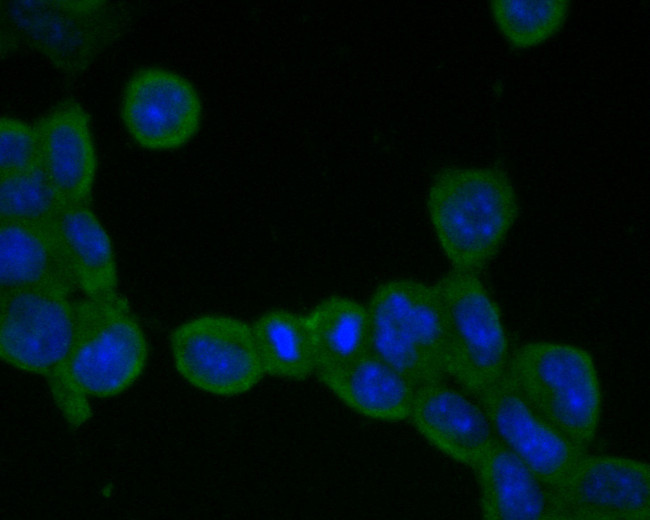 ADAM22 Antibody in Immunocytochemistry (ICC/IF)