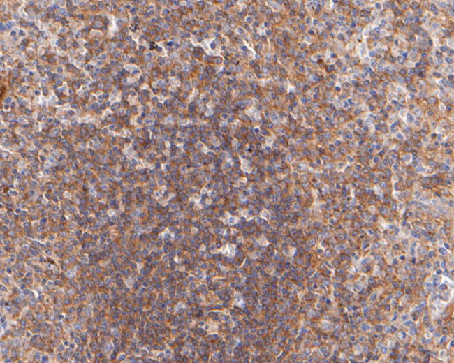 DTNBP1 Antibody in Immunohistochemistry (Paraffin) (IHC (P))