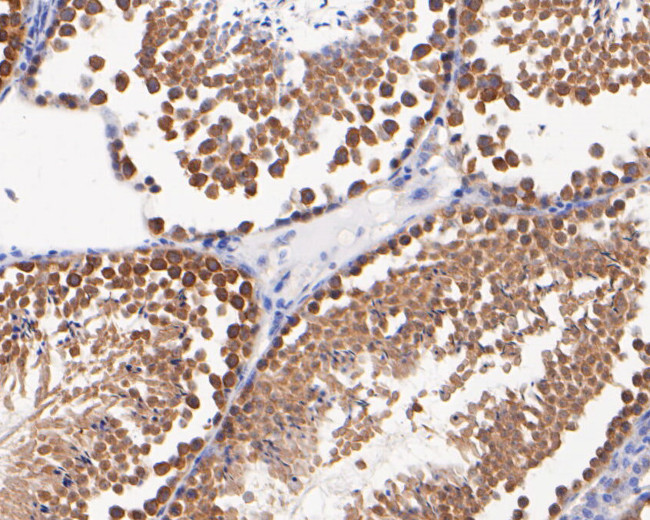 DTNBP1 Antibody in Immunohistochemistry (Paraffin) (IHC (P))