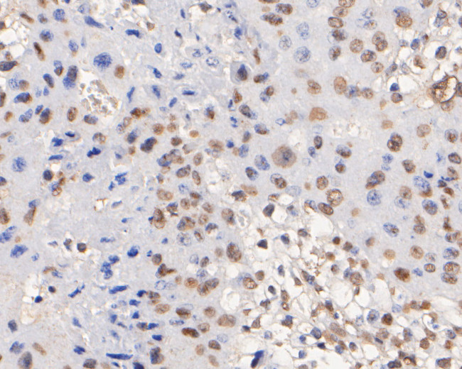 p16INK4a Antibody in Immunohistochemistry (Paraffin) (IHC (P))