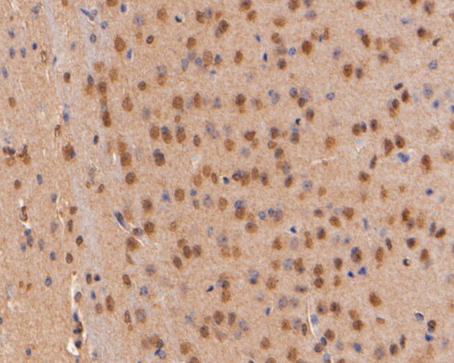 p16INK4a Antibody in Immunohistochemistry (Paraffin) (IHC (P))