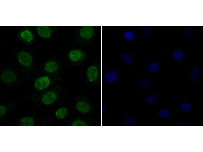 CLIC1 Antibody in Immunocytochemistry (ICC/IF)