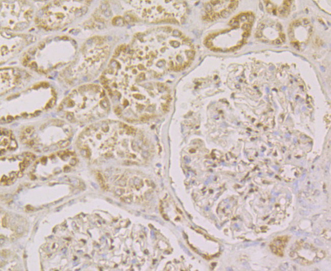 CLIC1 Antibody in Immunohistochemistry (Paraffin) (IHC (P))