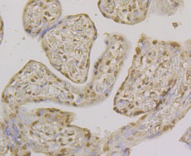 CLIC1 Antibody in Immunohistochemistry (Paraffin) (IHC (P))