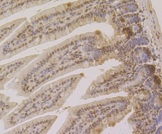 CLIC1 Antibody in Immunohistochemistry (Paraffin) (IHC (P))