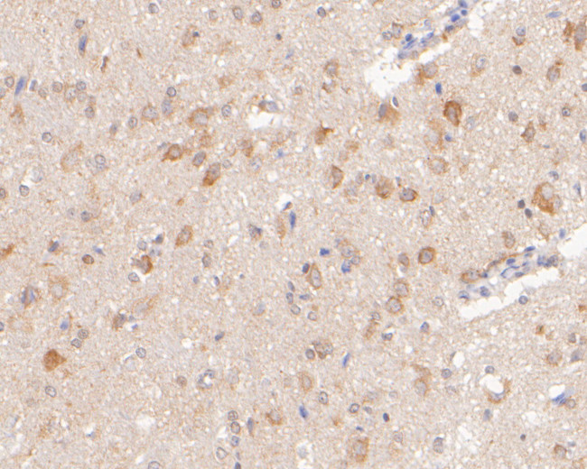 SYNDIG1 Antibody in Immunohistochemistry (Paraffin) (IHC (P))