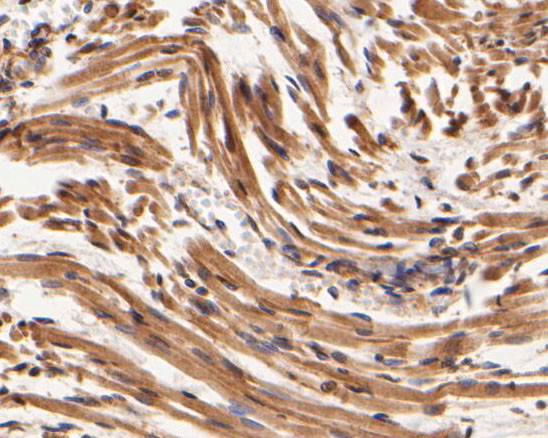 SYNDIG1 Antibody in Immunohistochemistry (Paraffin) (IHC (P))