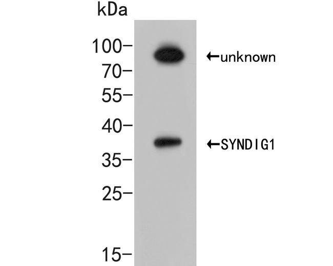 SYNDIG1 Antibody in Western Blot (WB)