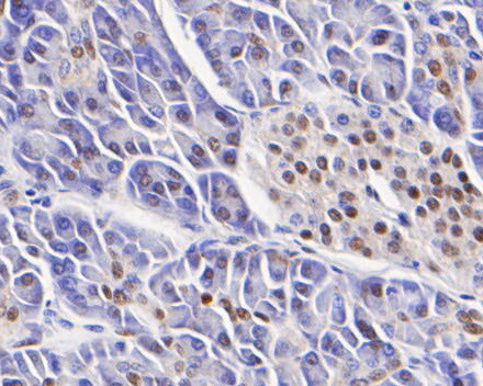 SSB Antibody in Immunohistochemistry (Paraffin) (IHC (P))