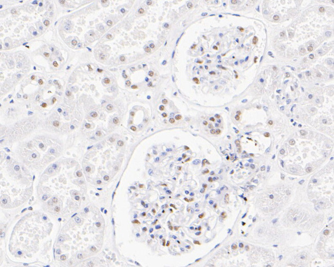 SSB Antibody in Immunohistochemistry (Paraffin) (IHC (P))