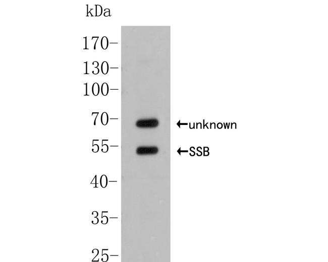 SSB Antibody in Western Blot (WB)