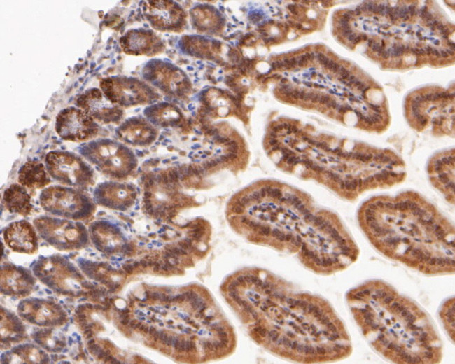 eIF6 Antibody in Immunohistochemistry (Paraffin) (IHC (P))