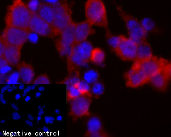 Zfp352 Antibody in Immunocytochemistry (ICC/IF)