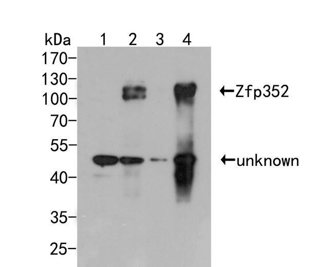Zfp352 Antibody in Western Blot (WB)