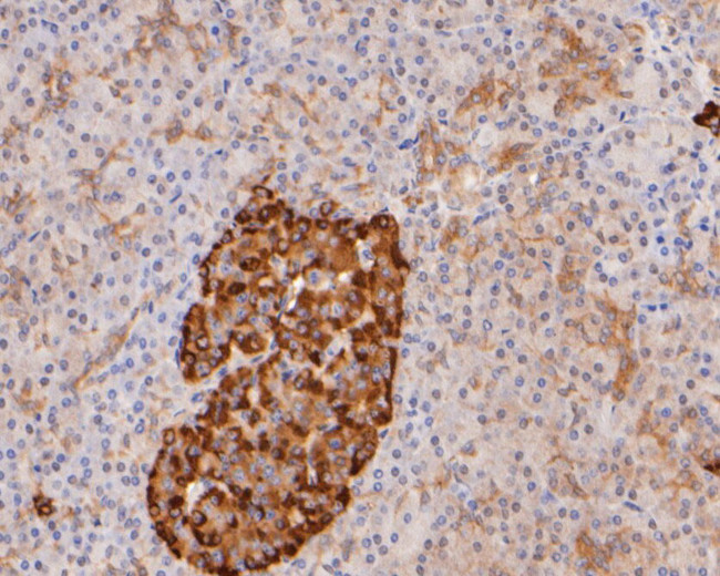 Apolipoprotein J Antibody in Immunohistochemistry (Paraffin) (IHC (P))