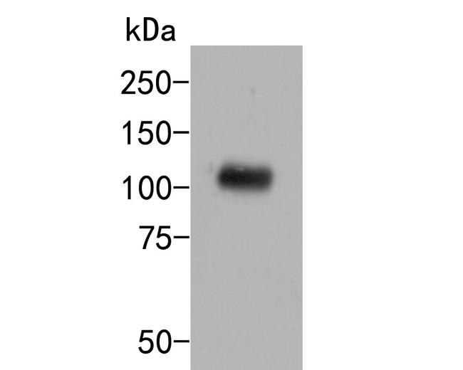 c-Cbl Antibody in Western Blot (WB)