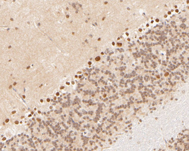 Cullin 4B Antibody in Immunohistochemistry (Paraffin) (IHC (P))