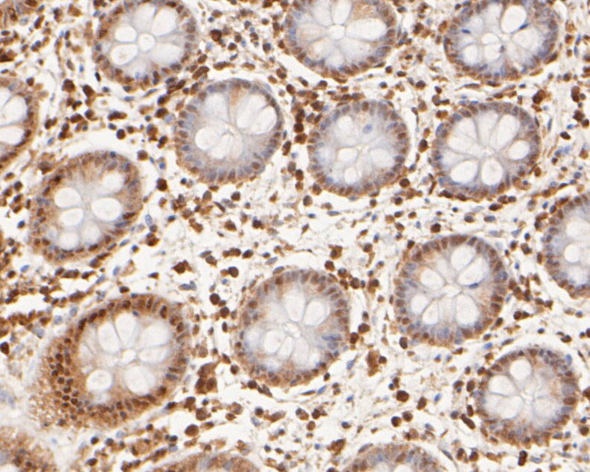 Cullin 4B Antibody in Immunohistochemistry (Paraffin) (IHC (P))