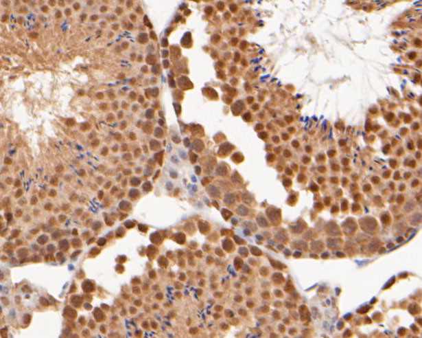 Cullin 4B Antibody in Immunohistochemistry (Paraffin) (IHC (P))