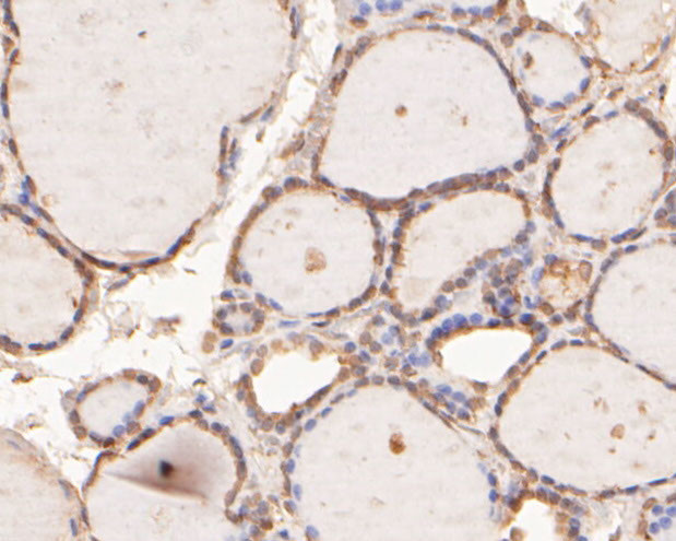 NAT13 Antibody in Immunohistochemistry (Paraffin) (IHC (P))