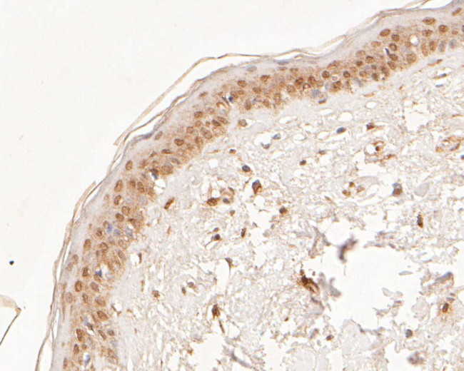 NAT13 Antibody in Immunohistochemistry (Paraffin) (IHC (P))