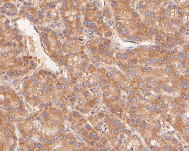 KAP3 Antibody in Immunohistochemistry (Paraffin) (IHC (P))