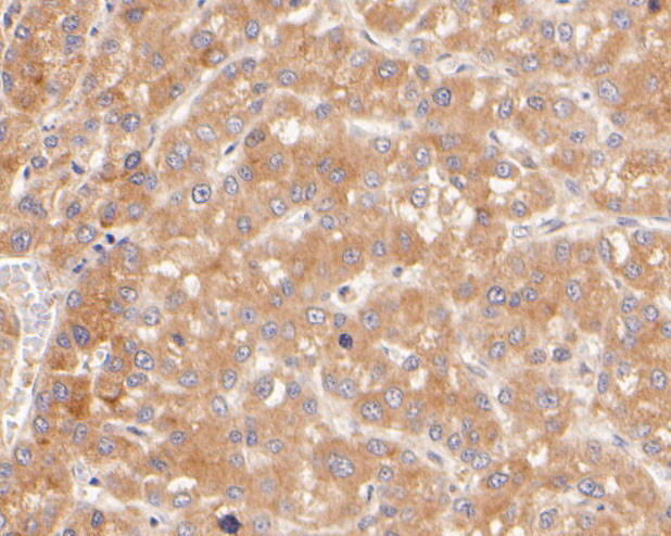 SERPINA6 Antibody in Immunohistochemistry (Paraffin) (IHC (P))