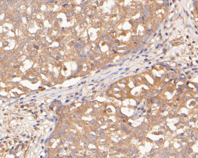 SERPINA6 Antibody in Immunohistochemistry (Paraffin) (IHC (P))