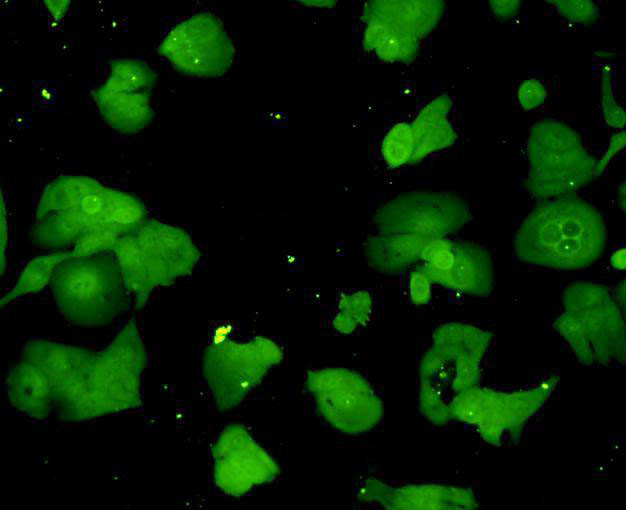 Ubiquitin Antibody in Immunocytochemistry (ICC/IF)