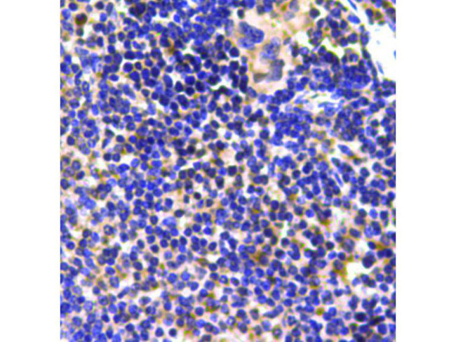 Ubiquitin Antibody in Immunohistochemistry (Paraffin) (IHC (P))