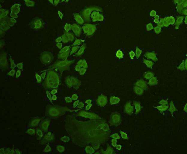 STAT1 alpha/beta Antibody in Immunocytochemistry (ICC/IF)