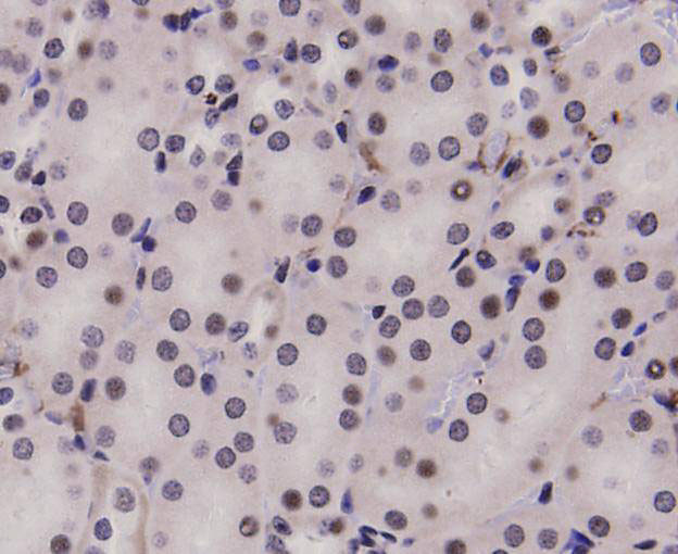 STAT1 alpha/beta Antibody in Immunohistochemistry (Paraffin) (IHC (P))