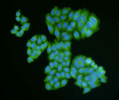 Desmin Antibody in Immunocytochemistry (ICC/IF)