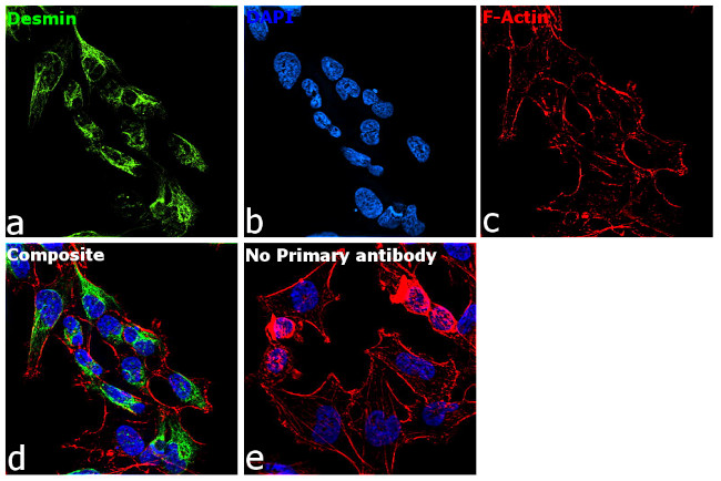 Desmin Antibody in Immunocytochemistry (ICC/IF)