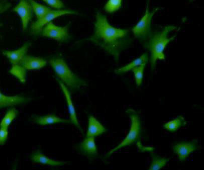 Desmin Antibody in Immunocytochemistry (ICC/IF)