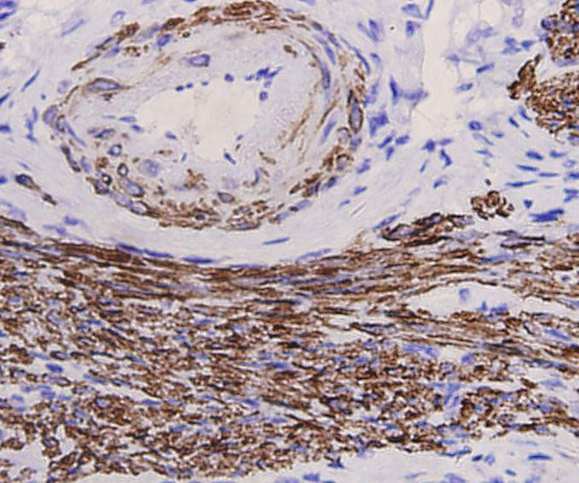 Desmin Antibody in Immunohistochemistry (Paraffin) (IHC (P))